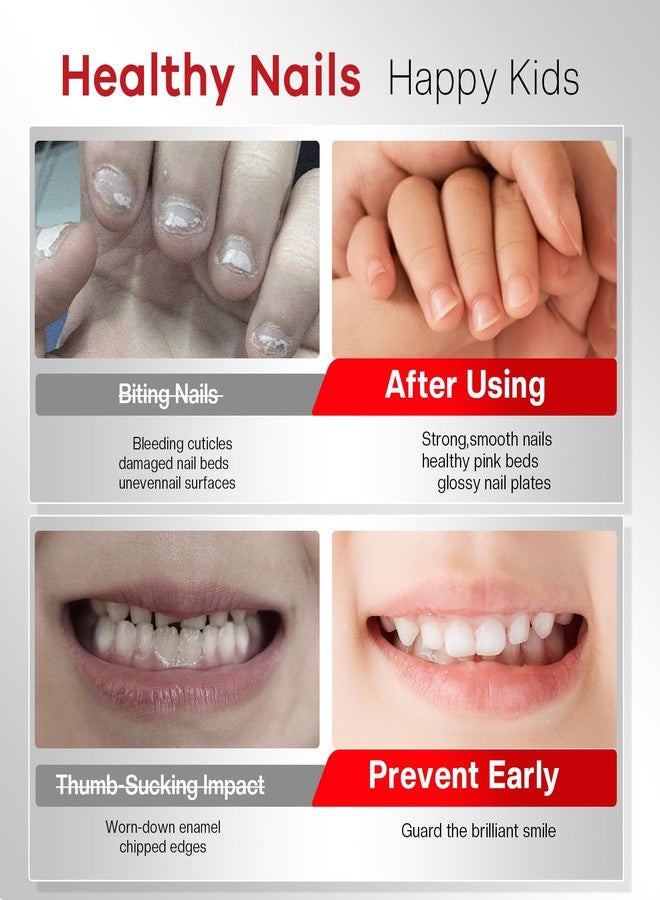 Glamonade Nail Biting Prevention For Kids: 12ml Extra Strong Nail Biting Treatment Anti Toddler Thumb Sucking Deterrent Stopper Nail Repair for Damaged Nails 48H Long Lasting Matte Odorless Onychophagy Relief - Image 5